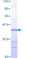 PSEN1 / Presenilin 1 Protein - 12.5% SDS-PAGE Stained with Coomassie Blue.