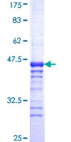 PSEN2 / Presenilin 2 Protein - 12.5% SDS-PAGE Stained with Coomassie Blue.