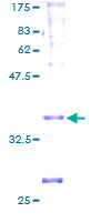 PSENEN / PEN-2 Protein - 12.5% SDS-PAGE of human PSENEN stained with Coomassie Blue