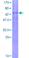 PSG1 / CD66f Protein - 12.5% SDS-PAGE of human PSG1 stained with Coomassie Blue