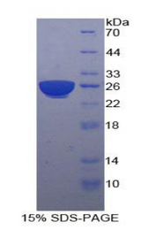 PSG1 / CD66f Protein - Recombinant Pregnancy Specific Beta-1-Glycoprotein 1 By SDS-PAGE