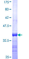 PSG11 Protein - 12.5% SDS-PAGE Stained with Coomassie Blue.