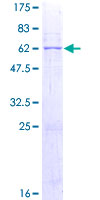PSG2 Protein - 12.5% SDS-PAGE of human PSG2 stained with Coomassie Blue