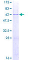 PSG2 Protein - 12.5% SDS-PAGE of human PSG2 stained with Coomassie Blue