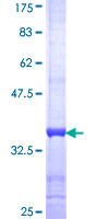 PSG2 Protein - 12.5% SDS-PAGE Stained with Coomassie Blue.