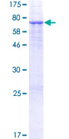 PSG3 Protein - 12.5% SDS-PAGE of human PSG3 stained with Coomassie Blue