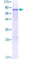 PSG3 Protein - 12.5% SDS-PAGE of human PSG3 stained with Coomassie Blue