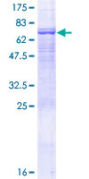 PSG6 Protein - 12.5% SDS-PAGE of human PSG6 stained with Coomassie Blue