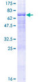 PSG6 Protein - 12.5% SDS-PAGE of human PSG6 stained with Coomassie Blue