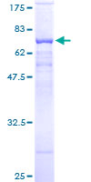 PSG9 Protein - 12.5% SDS-PAGE of human PSG9 stained with Coomassie Blue