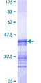 PSKH1 Protein - 12.5% SDS-PAGE Stained with Coomassie Blue.