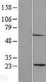 PSMA2 Protein - Western validation with an anti-DDK antibody * L: Control HEK293 lysate R: Over-expression lysate