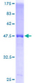 PSMA2 Protein - 12.5% SDS-PAGE of human PSMA2 stained with Coomassie Blue
