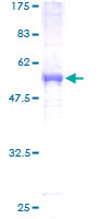 PSMA3 Protein - 12.5% SDS-PAGE of human PSMA3 stained with Coomassie Blue