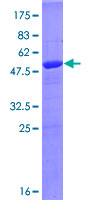 PSMA5 Protein - 12.5% SDS-PAGE of human PSMA5 stained with Coomassie Blue