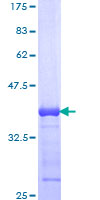 PSMA5 Protein - 12.5% SDS-PAGE Stained with Coomassie Blue.