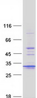 PSMA5 Protein - Purified recombinant protein PSMA5 was analyzed by SDS-PAGE gel and Coomassie Blue Staining