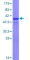 PSMA6 Protein - 12.5% SDS-PAGE of human PSMA6 stained with Coomassie Blue