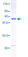 PSMA7 Protein - 12.5% SDS-PAGE of human PSMA7 stained with Coomassie Blue