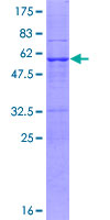 PSMA8 Protein - 12.5% SDS-PAGE of human PSMA8 stained with Coomassie Blue