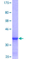 PSMA8 Protein - 12.5% SDS-PAGE Stained with Coomassie Blue.