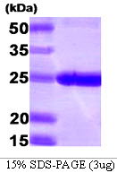 PSMB1 Protein
