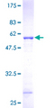 PSMB10 Protein - 12.5% SDS-PAGE of human PSMB10 stained with Coomassie Blue