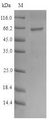 PSMB10 Protein - (Tris-Glycine gel) Discontinuous SDS-PAGE (reduced) with 5% enrichment gel and 15% separation gel.