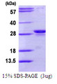 PSMB10 Protein
