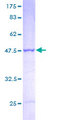 PSMB2 Protein - 12.5% SDS-PAGE of human PSMB2 stained with Coomassie Blue