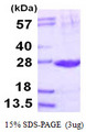 PSMB2 Protein