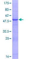 PSMB3 Protein - 12.5% SDS-PAGE of human PSMB3 stained with Coomassie Blue