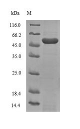 PSMB3 Protein - (Tris-Glycine gel) Discontinuous SDS-PAGE (reduced) with 5% enrichment gel and 15% separation gel.