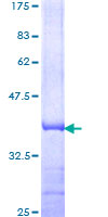 PSMB3 Protein - 12.5% SDS-PAGE Stained with Coomassie Blue.