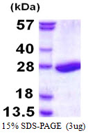 PSMB3 Protein