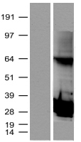 PSMB4 Protein - Western validation with an anti-DDK antibody * L: Control HEK293 lysate R: Over-expression lysate
