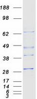 PSMB4 Protein - Purified recombinant protein PSMB4 was analyzed by SDS-PAGE gel and Coomassie Blue Staining