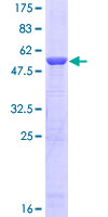 PSMB5 Protein - 12.5% SDS-PAGE of human PSMB5 stained with Coomassie Blue