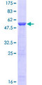 PSMB5 Protein - 12.5% SDS-PAGE of human PSMB5 stained with Coomassie Blue