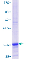 PSMB5 Protein - 12.5% SDS-PAGE Stained with Coomassie Blue.