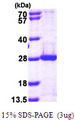 PSMB5 Protein