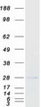 PSMB5 Protein - Purified recombinant protein PSMB5 was analyzed by SDS-PAGE gel and Coomassie Blue Staining