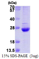 PSMB6 Protein