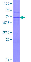 PSMB7 Protein - 12.5% SDS-PAGE of human PSMB7 stained with Coomassie Blue