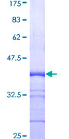 PSMB7 Protein - 12.5% SDS-PAGE Stained with Coomassie Blue.