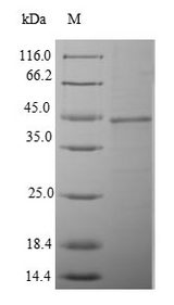 PSMB8 / LMP7 Protein - (Tris-Glycine gel) Discontinuous SDS-PAGE (reduced) with 5% enrichment gel and 15% separation gel.