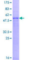PSMB8 / LMP7 Protein - 12.5% SDS-PAGE of human PSMB8 stained with Coomassie Blue