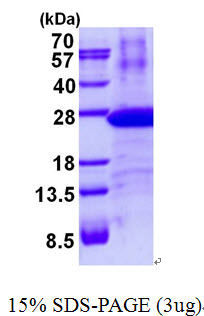 PSMB8 / LMP7 Protein