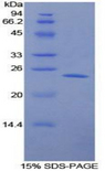 PSMB8 / LMP7 Protein - Recombinant Large Multifunctional Peptidase 7 By SDS-PAGE