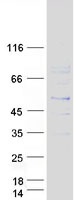 PSMB8 / LMP7 Protein - Purified recombinant protein PSMB8 was analyzed by SDS-PAGE gel and Coomassie Blue Staining